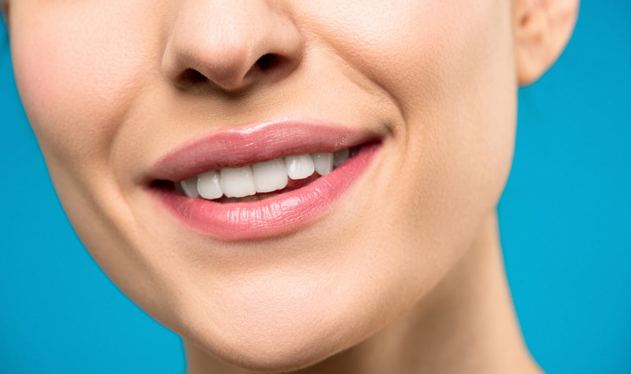 Hollywood Smile Makeover in Turkey
