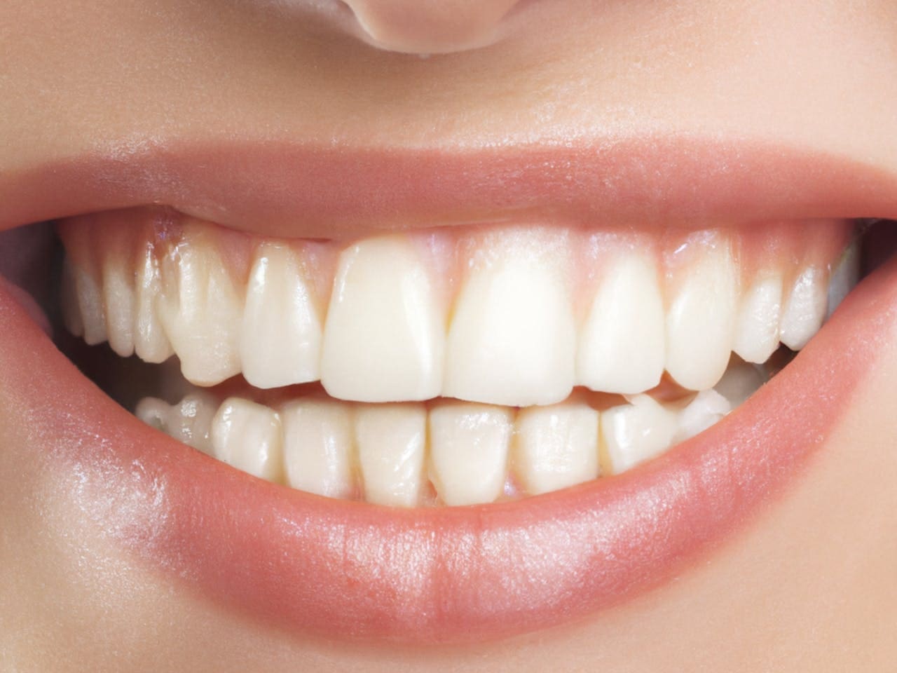 Clear Dental Plaques in Turkey