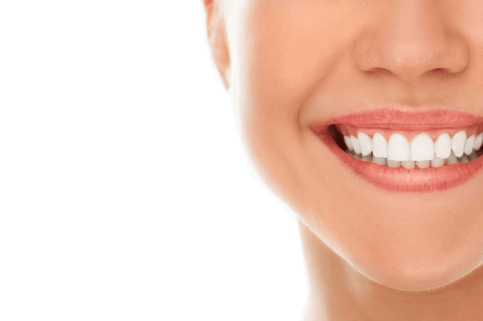 Teeth Whitening Before and After Results