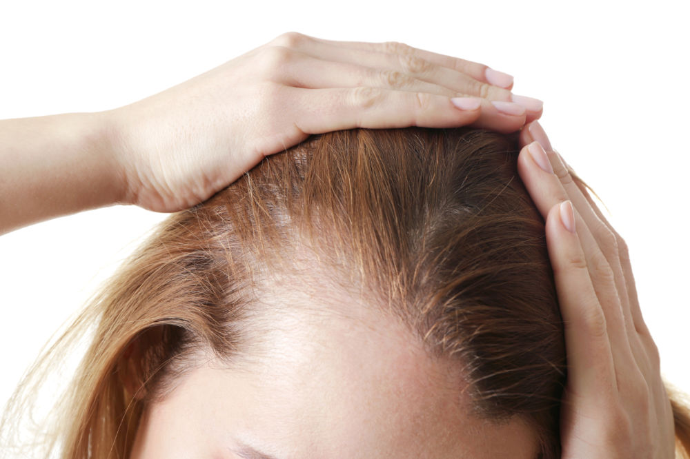 Hair Transplant Illustration