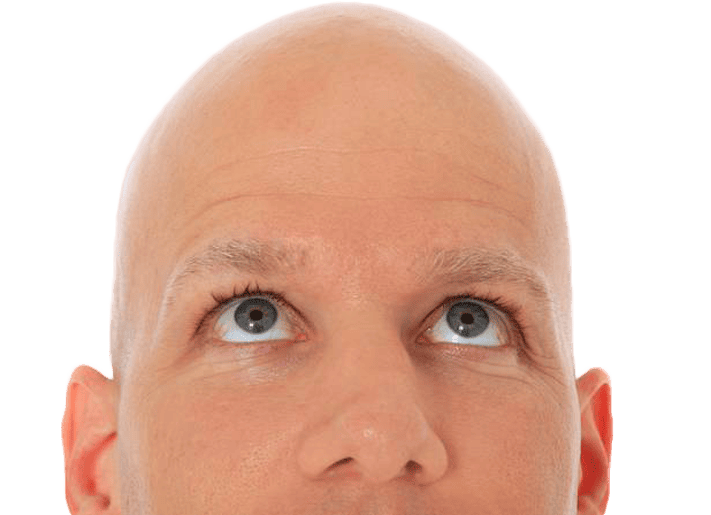 Sapphire FUE Hair Transplant