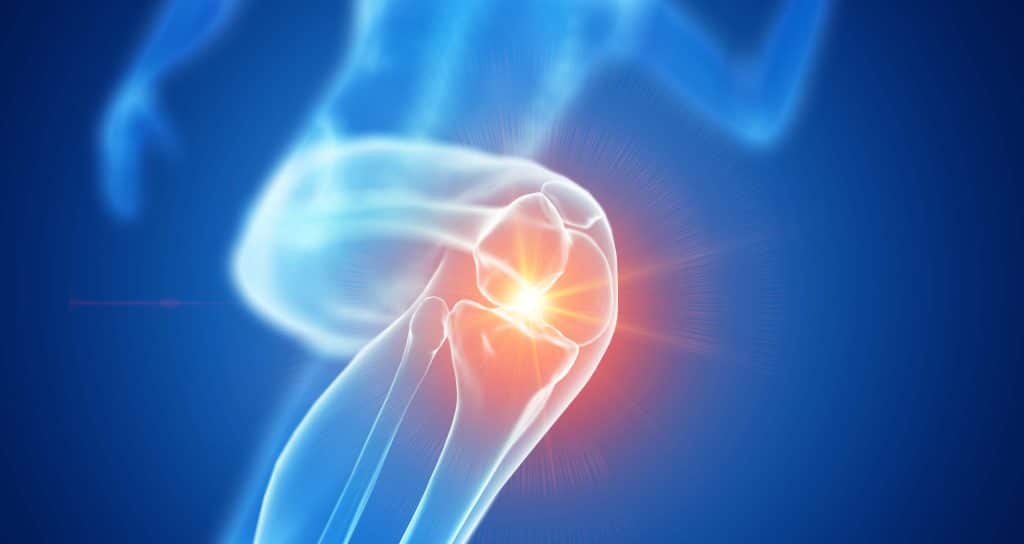 Knee Replacement Surgery in Turkey