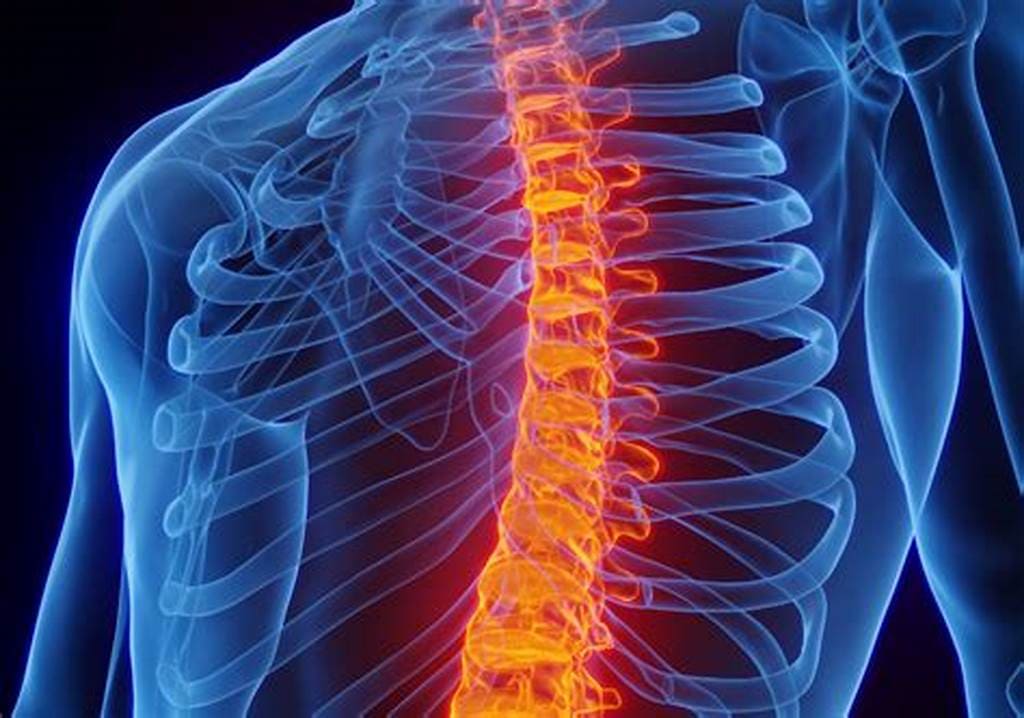Spine Surgery Recovery