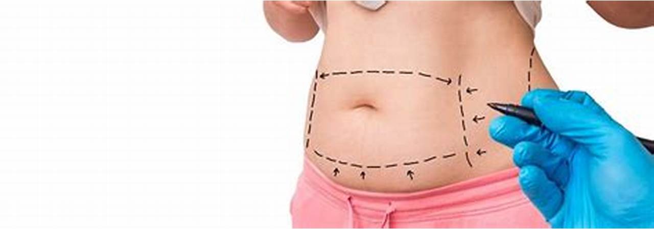 Tummy Tuck and Liposuction